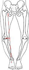 Ｏ脚解剖学的指標1